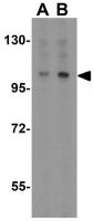 MTBP antibody