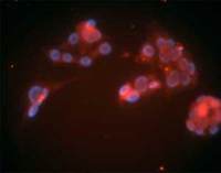 LDL Receptor antibody [15C8]