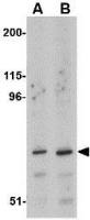 ASAH2 antibody