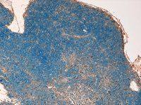 STAT3 (isoform 1/2) antibody, C-term