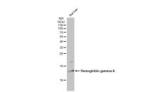 Hemoglobin gamma A antibody