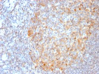 MALT1 antibody [MT1/3159R]