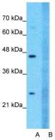 Claudin 18 antibody, C-term