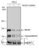 ROCK1 antibody