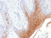 Cytokeratin 10 antibody [KRT10/1990R]