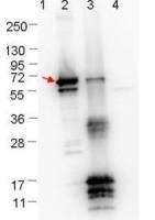 Borrelia burgdorferi Erpn/Ospe antibody