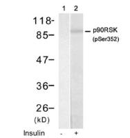 p90 RSK1 (phospho Ser363) antibody