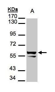 Cytokeratin 6 antibody