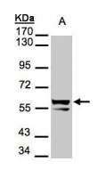 Cytokeratin 6 antibody