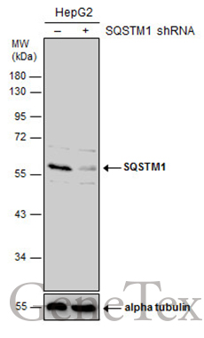 SQSTM1 / P62 antibody