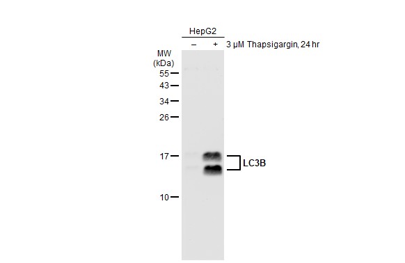 LC3B antibody [GT1187]