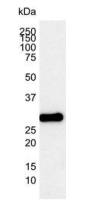 Bcl-2 antibody [100]