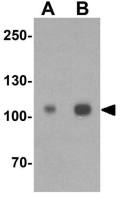 ERAP1 antibody