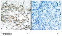 FOXO4 (phospho Ser197) antibody
