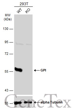GPI antibody
