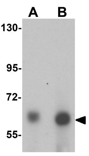 ANKLE1 antibody