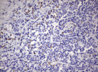 ZEB2 antibody [OTI1E12]
