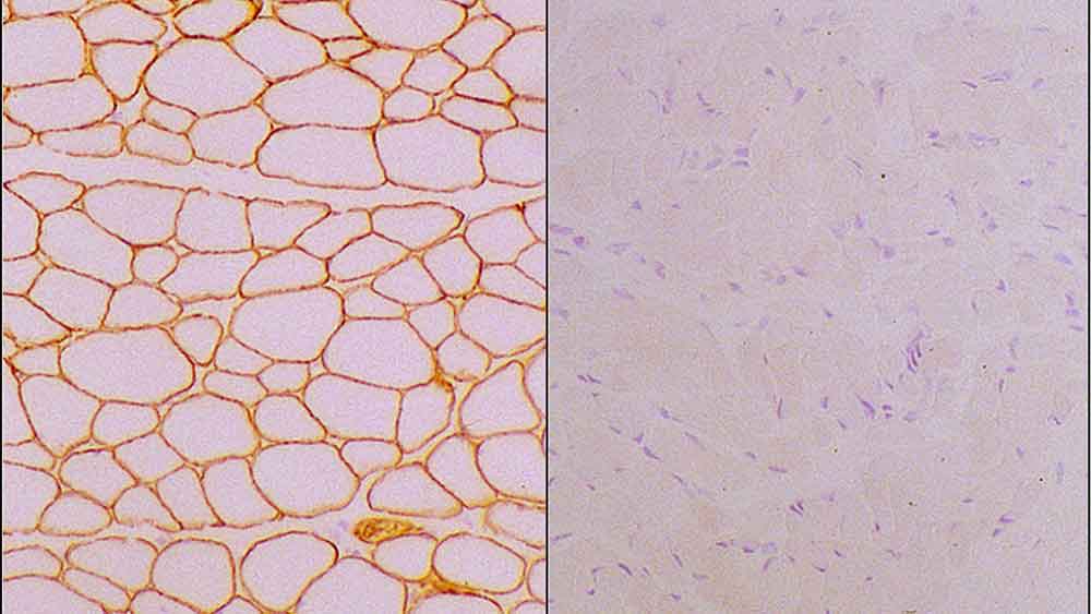 Laminin alpha 2 antibody [Mer3/22B2]