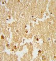 ERR beta antibody, Internal