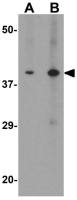 TRIB3 antibody