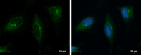 PKD2 antibody [C1C3]