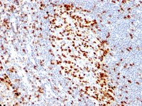 ZAP70 antibody [ZAP70/528]