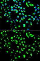 14-3-3 theta antibody