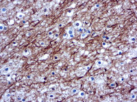 NF-H + NF-L antibody [2F11]