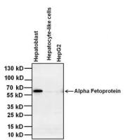 Alpha fetoprotein / AFP antibody [P5B8]