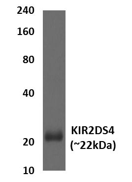 KIR2DS4 antibody [2G42]
