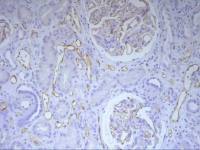 C4d antibody [10-11]