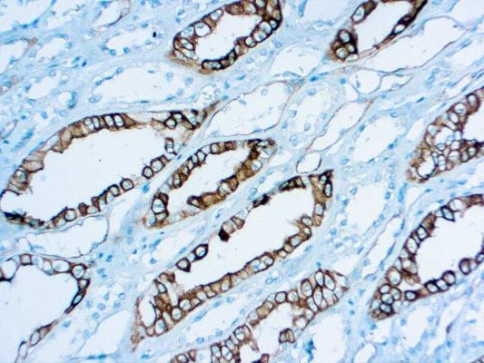 Renal Cell Carcinoma antibody [PN-15]