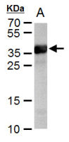 Cre recombinase antibody