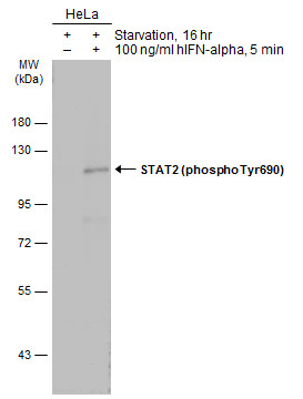 STAT2 (phospho Tyr690) antibody