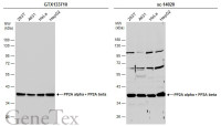 PP2A alpha + PP2A beta antibody