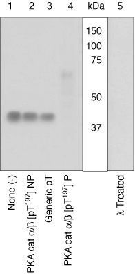 PKC beta 2 (phospho Thr641) antibody