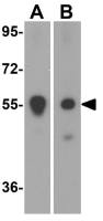 PINK1 antibody