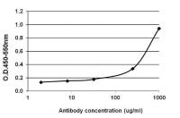 MMP2 antibody [F14 P4 D3]