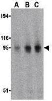 TLR11 antibody