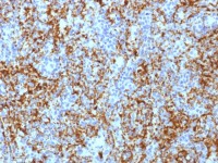 Integrin beta 3 antibody [ITGB3/1713]