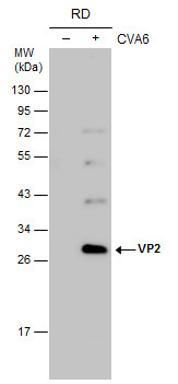 Coxsackievirus A6 VP2 antibody