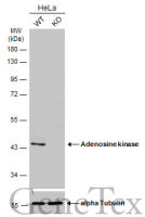 Adenosine kinase antibody [N1C1]