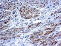 Caldesmon antibody [hHCD]