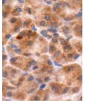 Chromogranin B antibody
