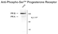 Progesterone Receptor (phospho Ser294) antibody [608]