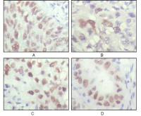 Chk2 antibody [1C12B8]