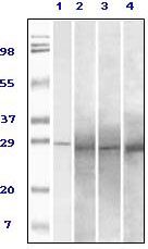 Rab25 antibody [3F12F3]