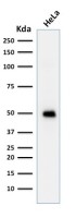 p53 antibody [TRP/817]