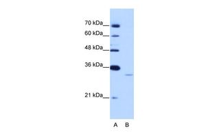 EXOSC6 antibody, N-term