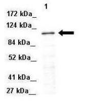 NEDD4 antibody, Internal